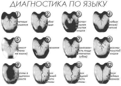 Диагностика по языку в китайской медицине картинки